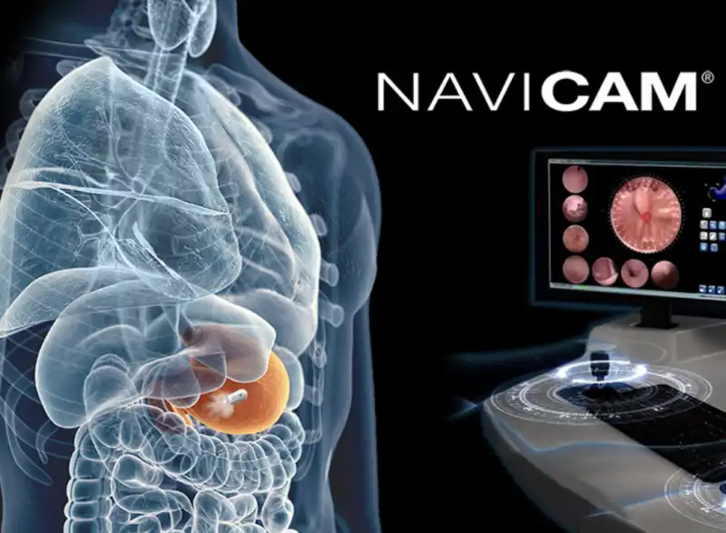 NAVICAM STOMACH SYSTEM