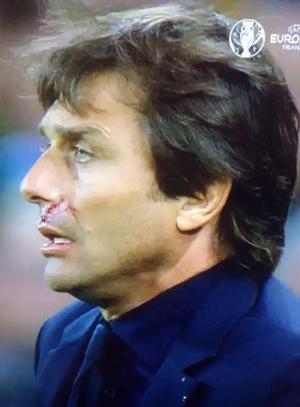 antonio conte sangue dopo il gol