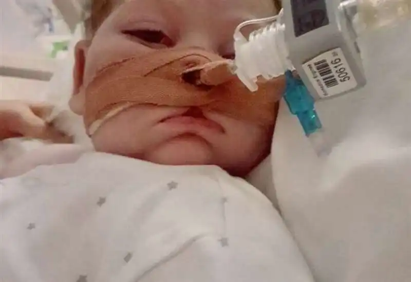 charlie gard 2