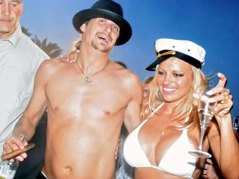 pamela anderson e kid rock 1