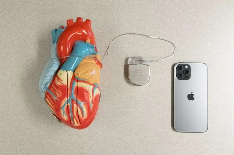 IPHONE PACEMAKER 2