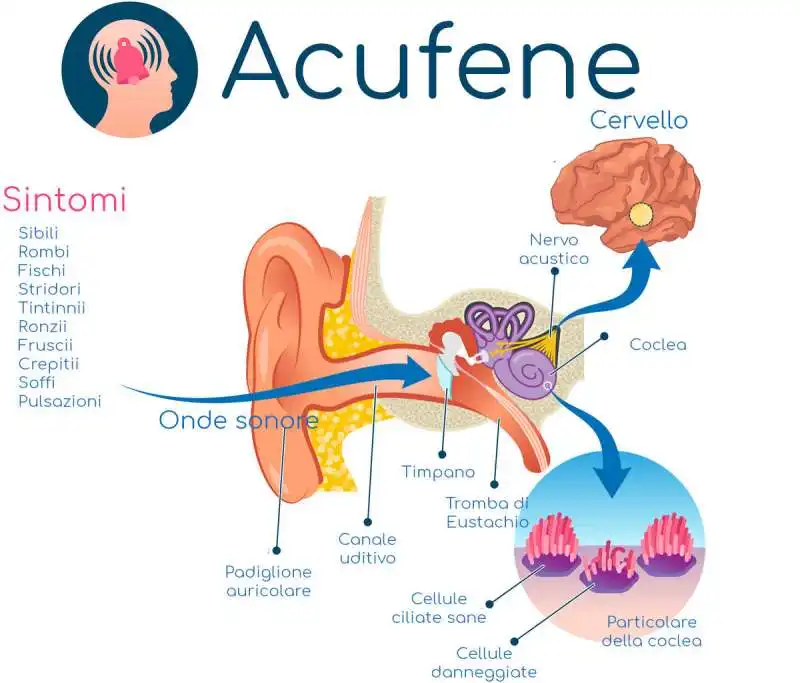 ACUFENE