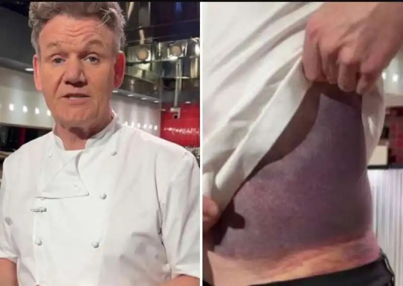 incidente in bici per gordon ramsay 1