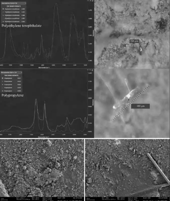 microplastiche trovate nel tessuto del pene  