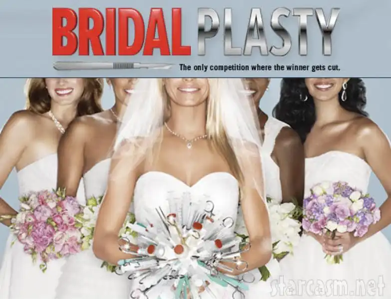 Bridalplasty 