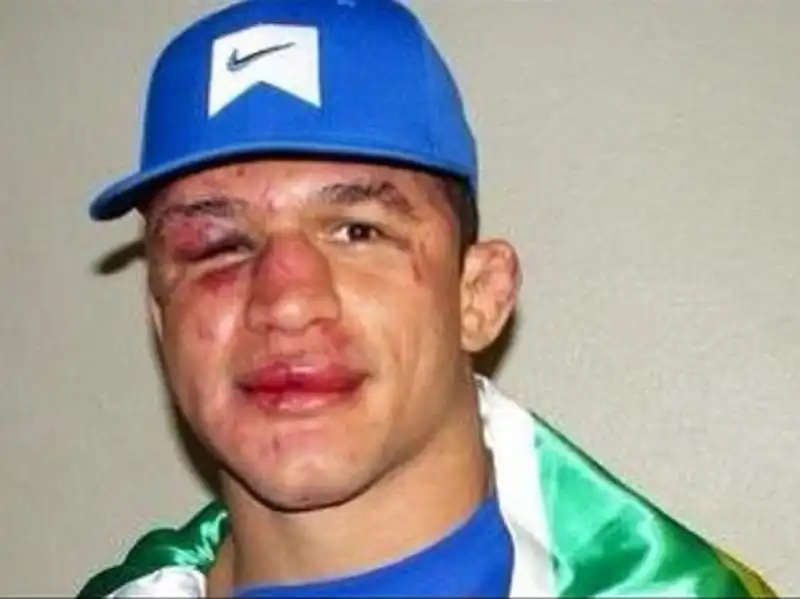 JUNIOR DOS SANTOS DOPO 