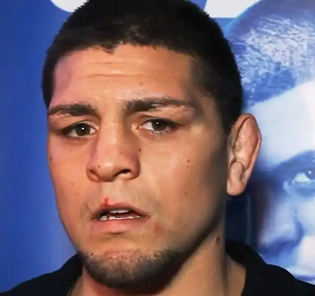 NICK DIAZ PRIMA 