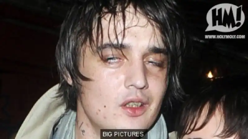 pete doherty 1