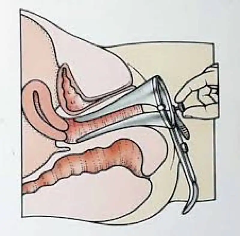 SPECULUM