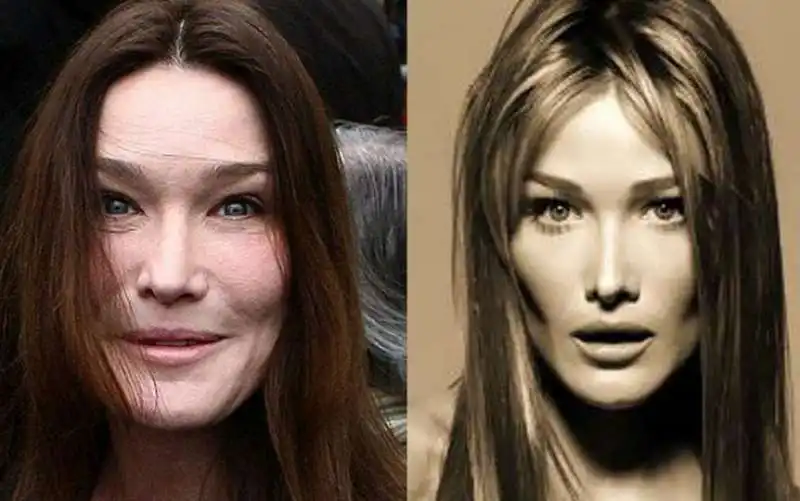 carla bruni prima e dopo