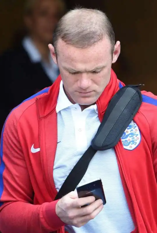 wayne rooney e i capelli  4