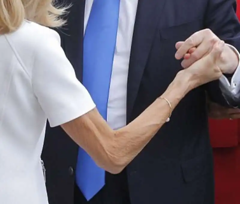 il braccino di brigitte macron