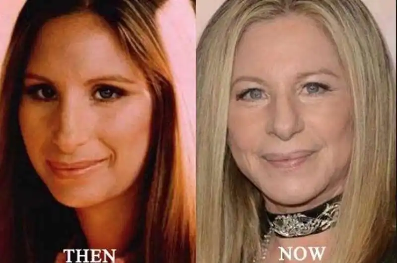 barbra streisand 1