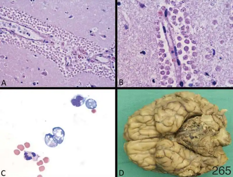 naegleria foowleri, l'ameba che mangia il cervello 4