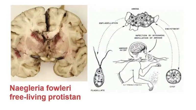 naegleria foowleri, l'ameba che mangia il cervello 6