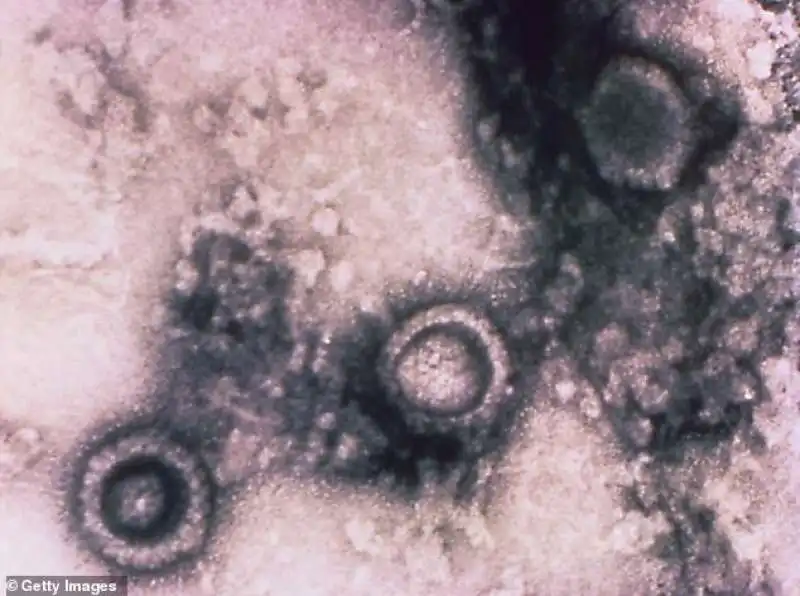 Il virus dell'herpes