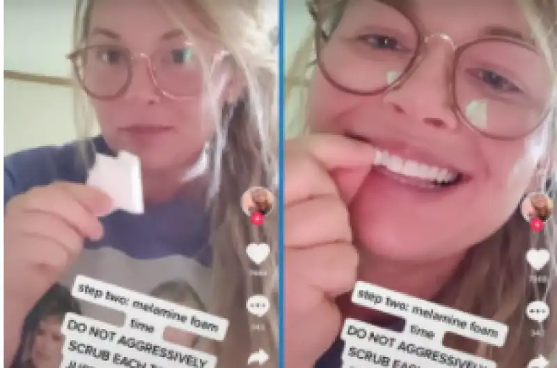 video tik tok Heather Dunn che insegna a sbiancarsi i denti con uno smacchiatore per superfici