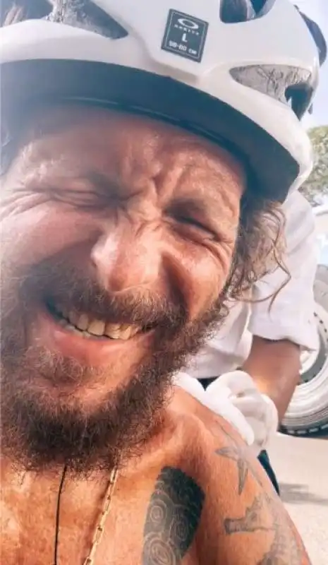 jovanotti dopo l incidente in bicicletta a santo domingo   9