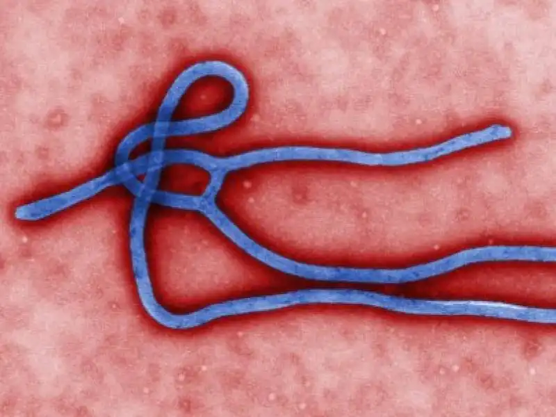 ebola