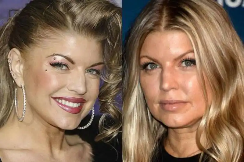 fergie