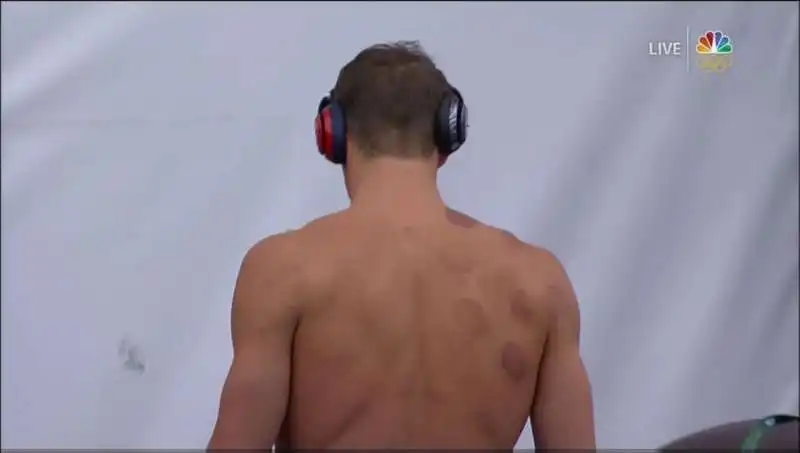 michael phelps cupping 