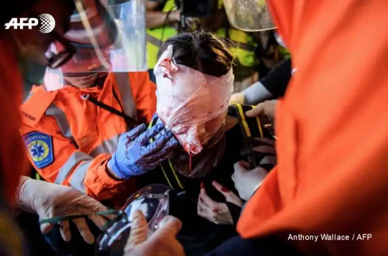 PROTESTE E VIOLENZA A HONG KONG