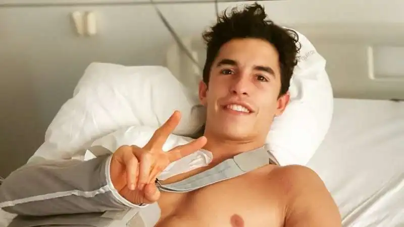 marc marquez dopo l'operazione 1