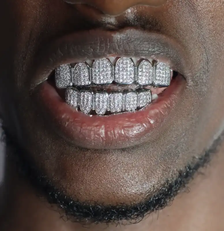 grillz - dentatura in diamanti