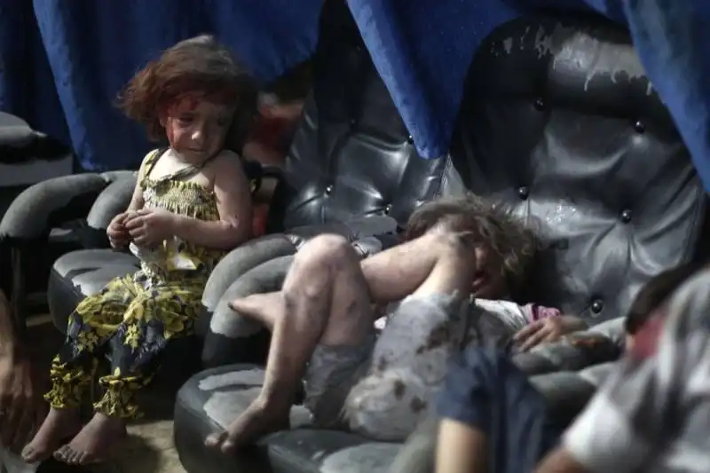 bambini feriti in siria