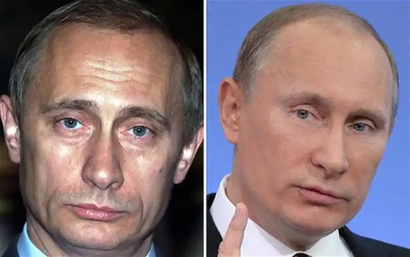 putin prima e  dopo il botox