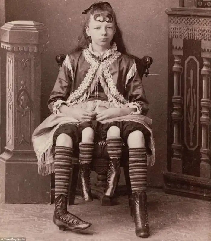 myrtle corbin nata con quattro gambe