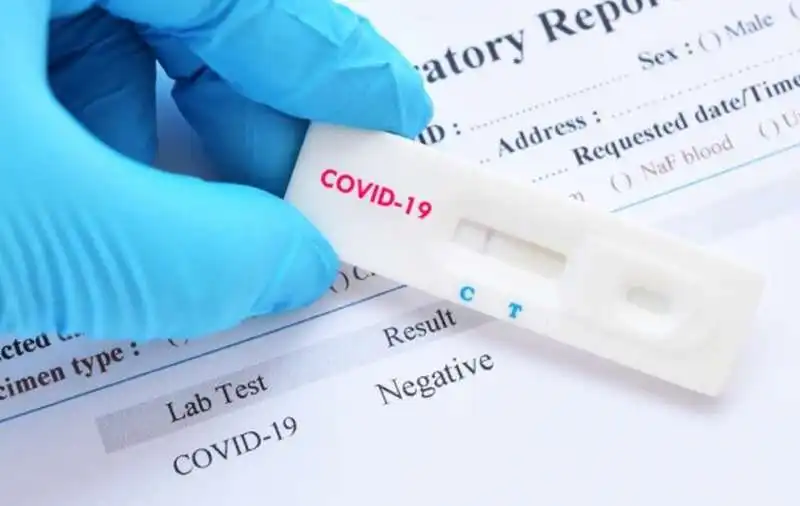 TEST RAPIDO CORONAVIRUS