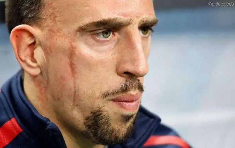 franck ribery 5