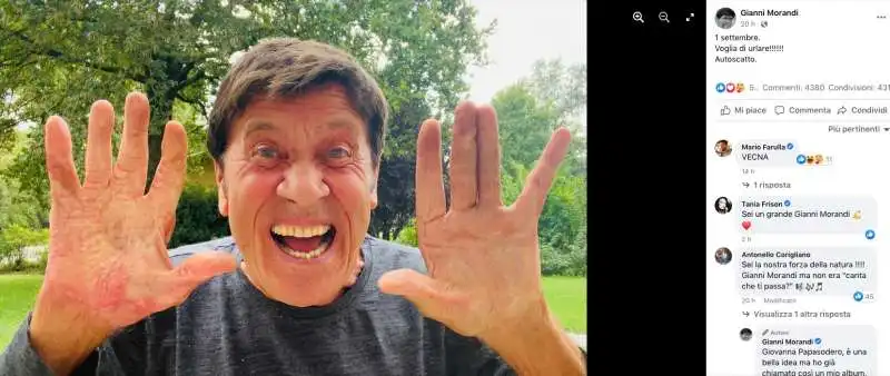 GIANNI MORANDI POST FACEBOOK SULLE MANI