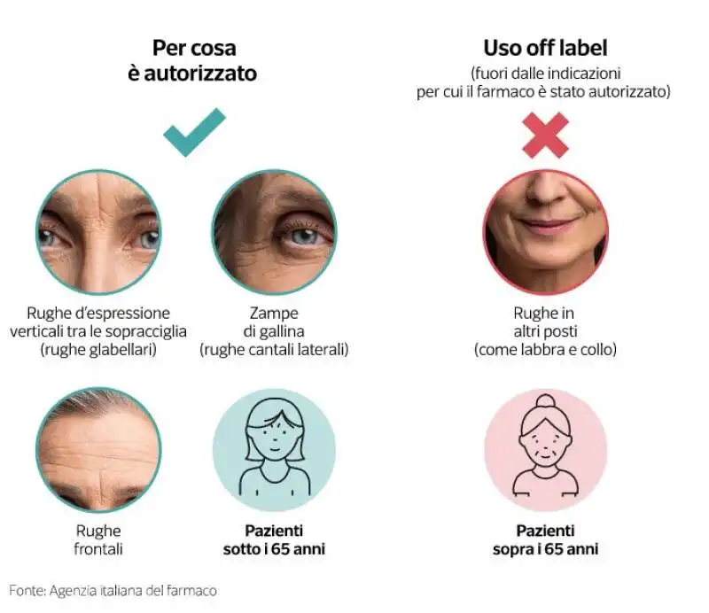 botulino e botox in italia   dataroom