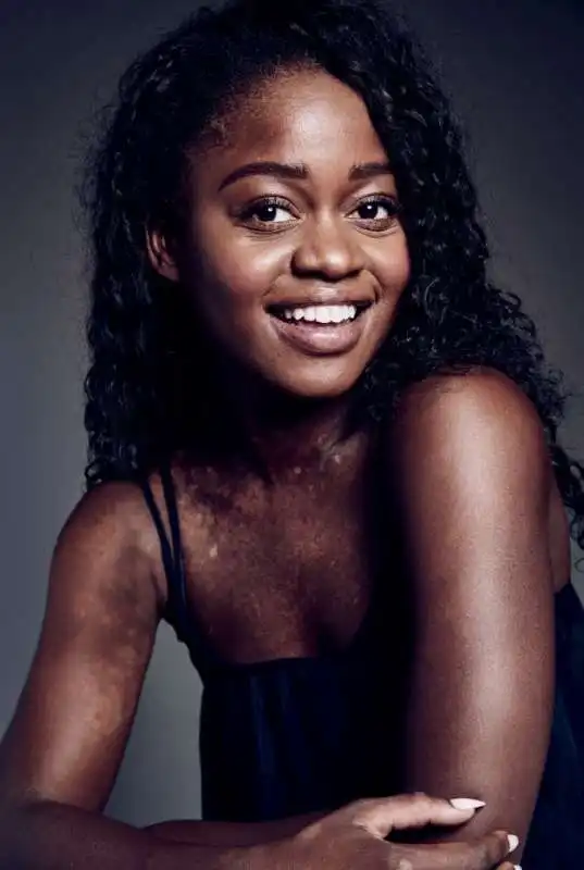 michaela deprince  4