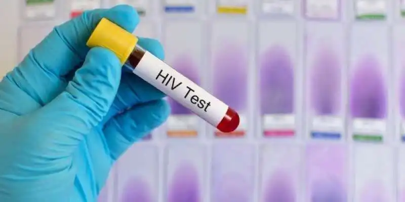 hiv