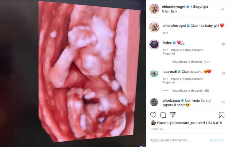 ECOGRAFIA DI CHIARA FERRAGNI