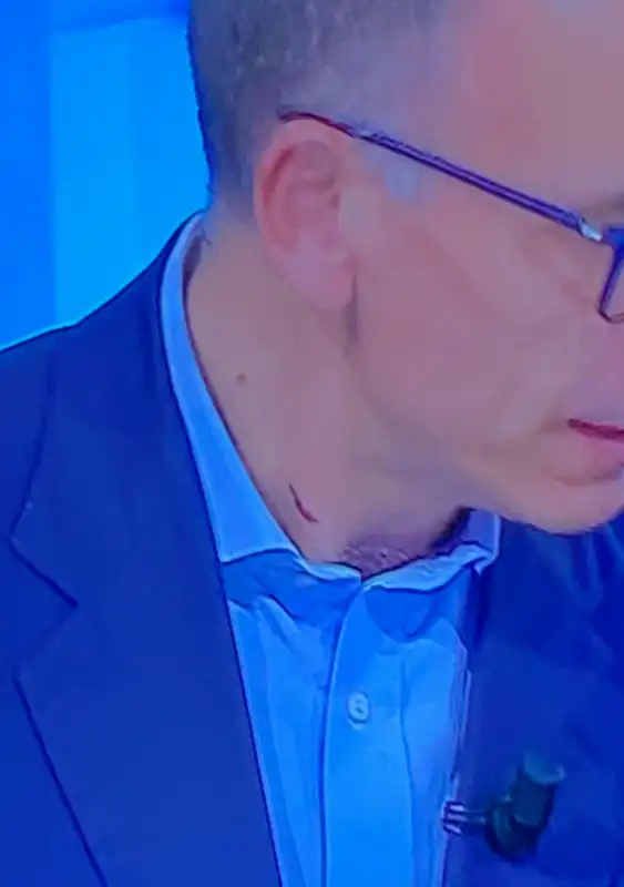 enrico letta con i tagli sopra il colletto della camicia