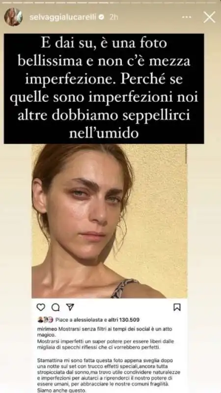 LA STORY DI SELVAGGIA LUCARELLI SULLE IMPERFEZIONI DI MIRIAM LEONE