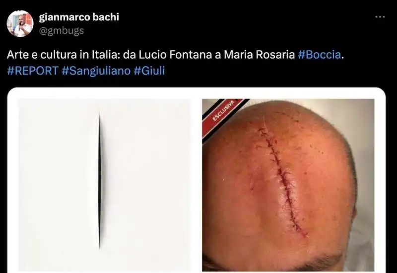 TWEET SUL GRAFFIO NELLA TESTA DI GENNARO SANGIULIANO