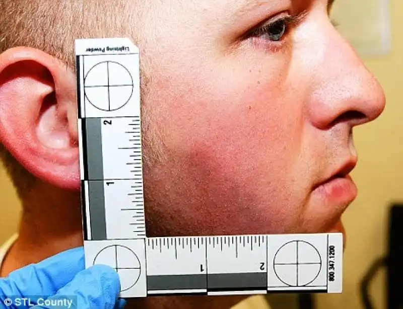 darren wilson dopo lo scontro con michael brown