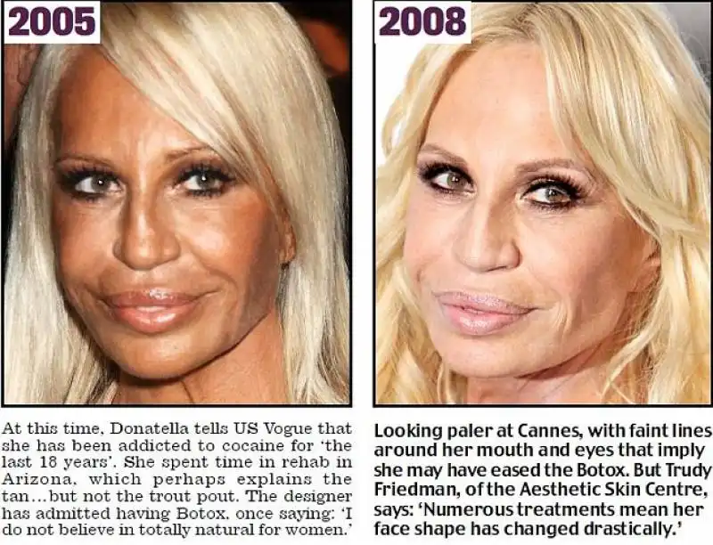 donatella versace 1