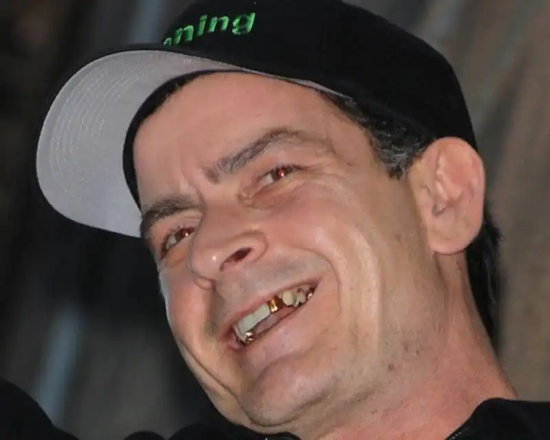 charlie sheen perde i denti per le droghe