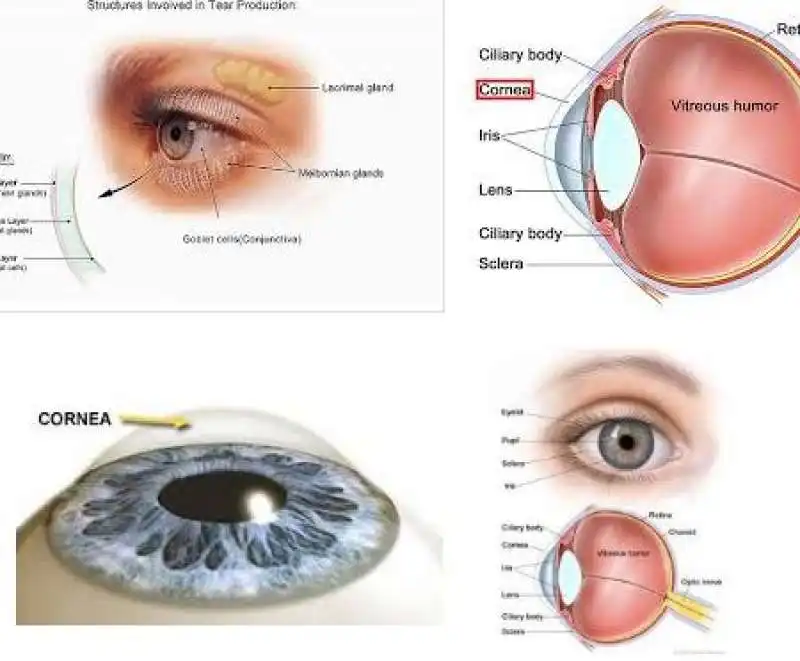 espianto cornea