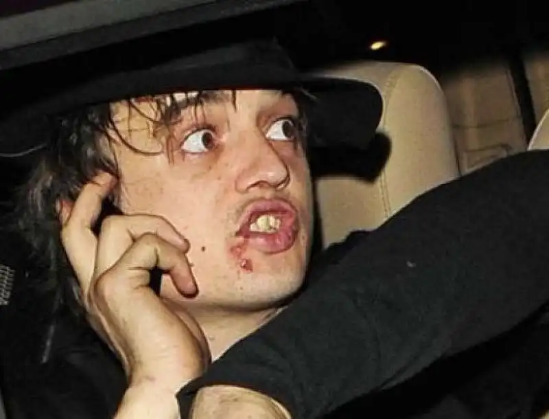 pete doherty 1