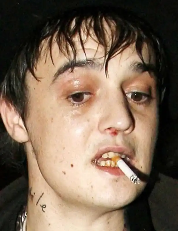 pete doherty 10