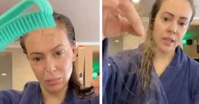 ALYSSA MILANO MOSTRA I CAPELLI PERSI A CAUSA DEL COVID