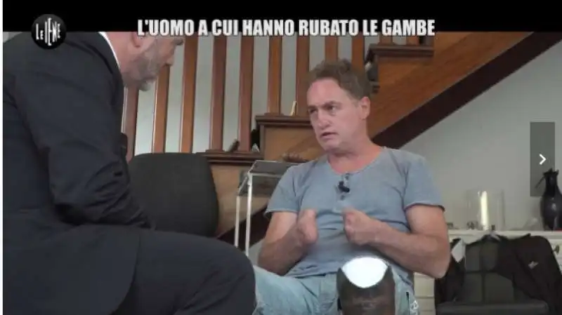 iene servizio  uomo che ha rubato le gambe 6