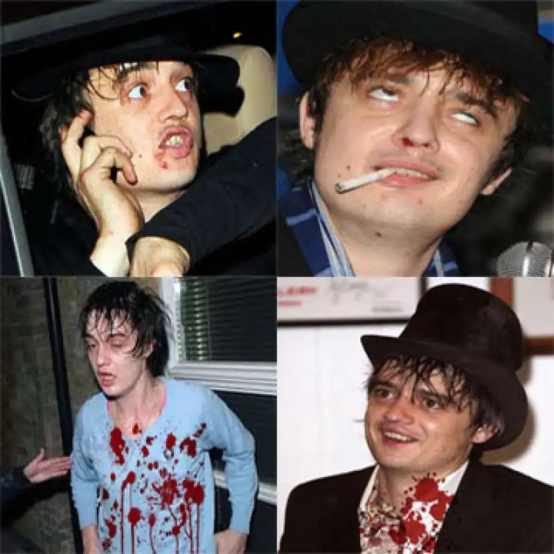 pete doherty 1